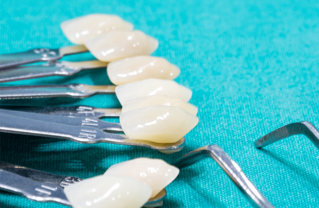 Coroane-dentare-5