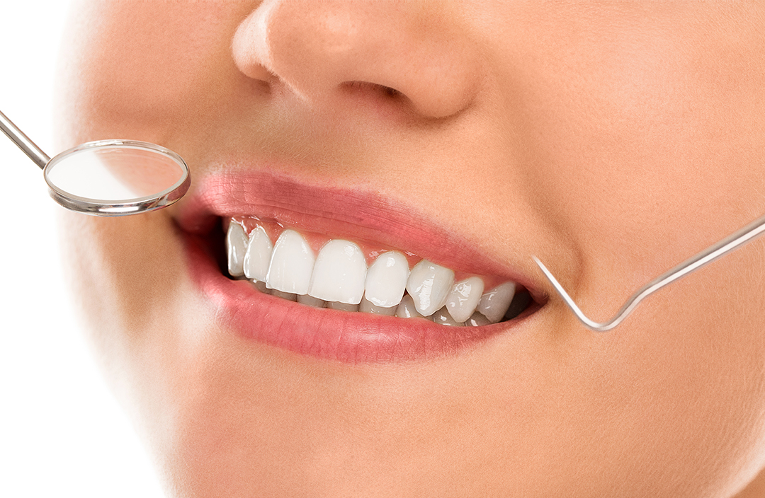 Implant-dentar-5
