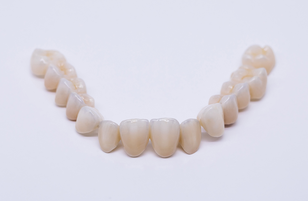 coroane-dentare-1