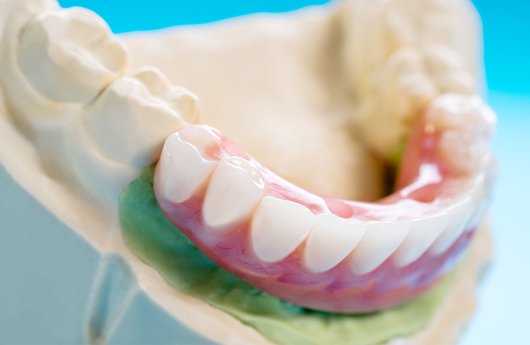 proteze-dentare-3