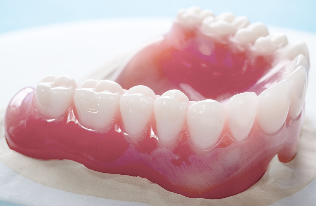 proteze-dentare-5