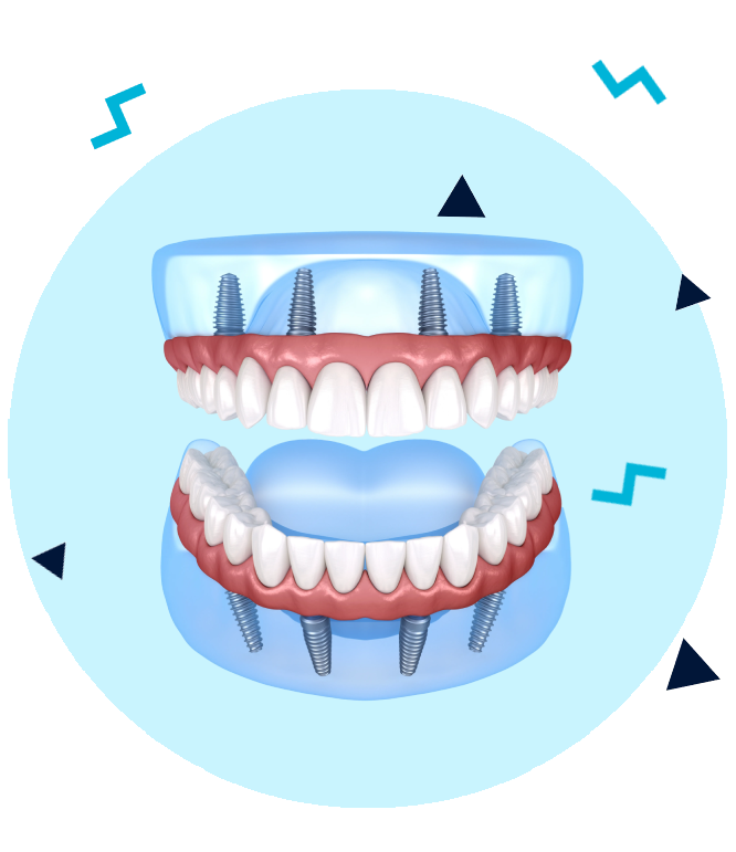 proteze-dentare-fixe Proteze dentare fixe