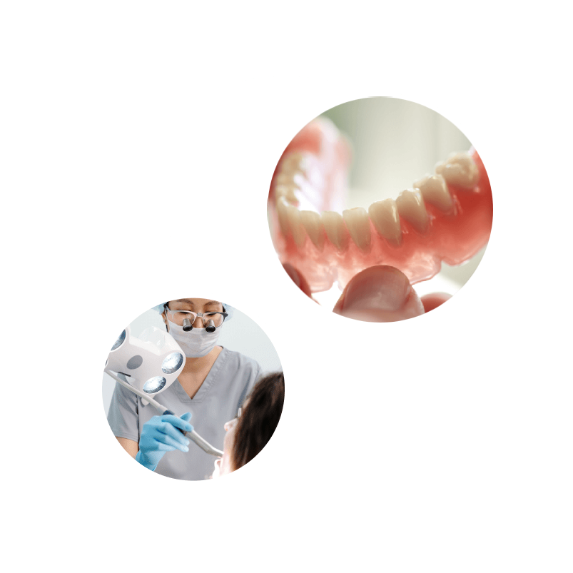 proteze-dentare-flexibile-img2